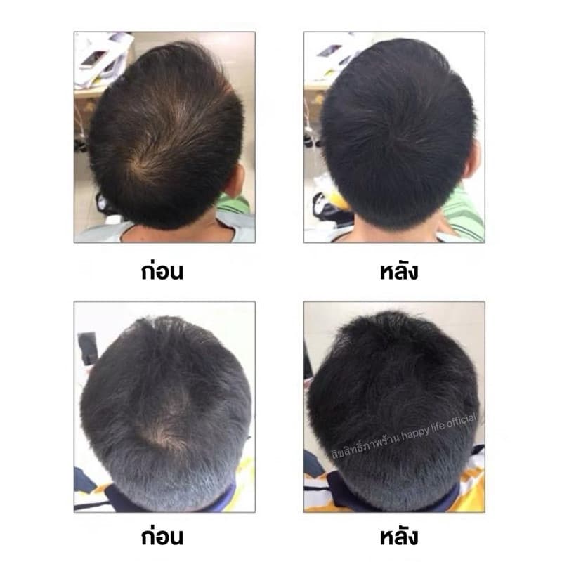 ‍สเปรย์ไฟเบอร์ ปิดผมบาง ผมขาว หัวไข่ดาว รอยเเสก kingyes‍ รูปที่ 3