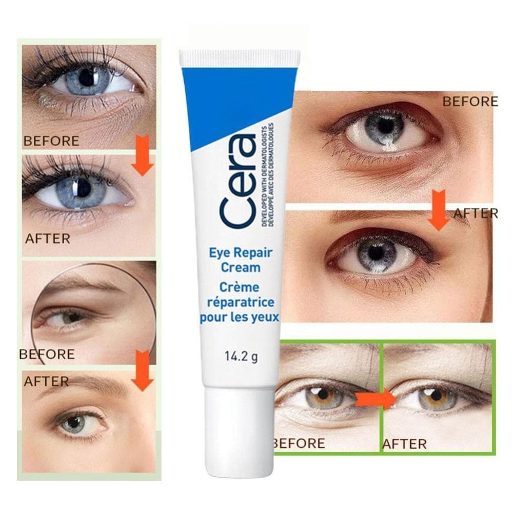 Feelfly Eye Cream Repair Skin Barrier สําหรับ Dark Circles ใต้ตา Moisturizing ลด Black Circle Eye Cream Whitening Anti-Fine เส้น Eye Care Q4Z4 รูปที่ 6