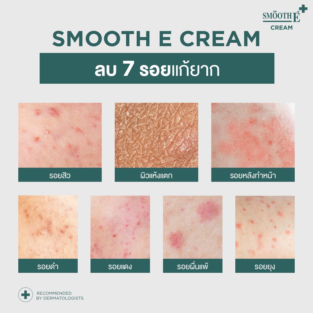 Smooth E Cream Plus White 10g. สมูทอี ครีมพลัสไวท์ ลดริ้วรอย ผื่นแดง รอยหัตถการ แผลเป็น จุดดำ ปรับผิวใส รูปที่ 3
