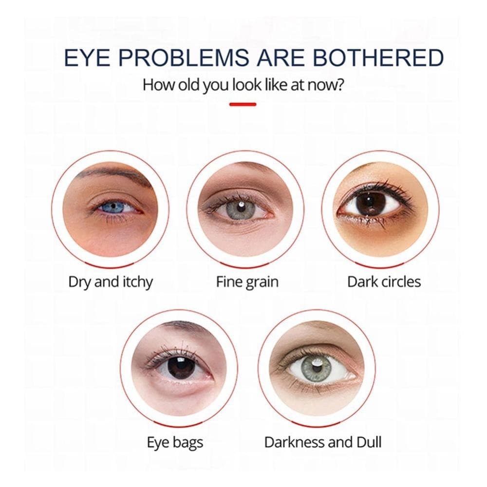 Feelfly Eye Cream Repair Skin Barrier สําหรับ Dark Circles ใต้ตา Moisturizing ลด Black Circle Eye Cream Whitening Anti-Fine เส้น Eye Care Q4Z4 รูปที่ 7