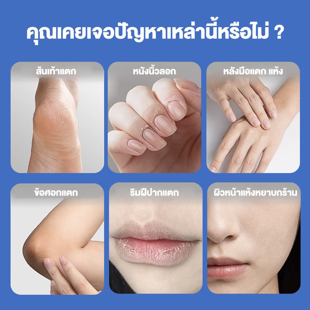 ครีมบํารุงผิวเท้า ครีมทามือและเท้า ครีมวิตามินซี Deep Moisture Cream ครีมแก้เท้าแตกเร่งด่ว น บำรุงเท้าแตกแห้ง รูปที่ 6