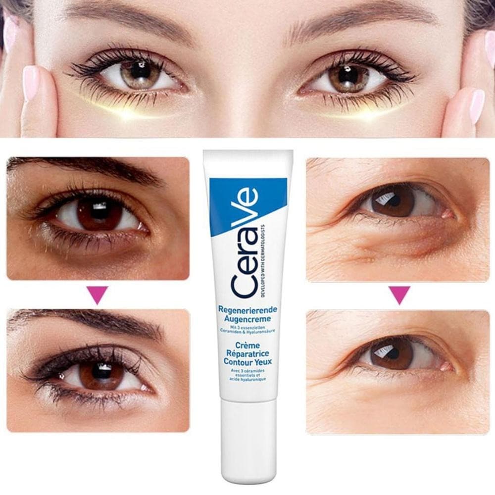 Feelfly Eye Cream Repair Skin Barrier สําหรับ Dark Circles ใต้ตา Moisturizing ลด Black Circle Eye Cream Whitening Anti-Fine เส้น Eye Care Q4Z4 รูปที่ 2