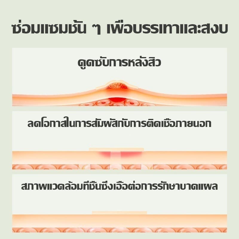 แผ่นแปะสิว แผ่นแปะรักษาสิว แผ่นสิว แผ่นแปะดูดสิว แผ่นดูดสิว แผ่นสติกเกอร์แปะสิว Acne Patches รูปดาวน่ารัก หลากสีสัน 7 สี รูปที่ 5