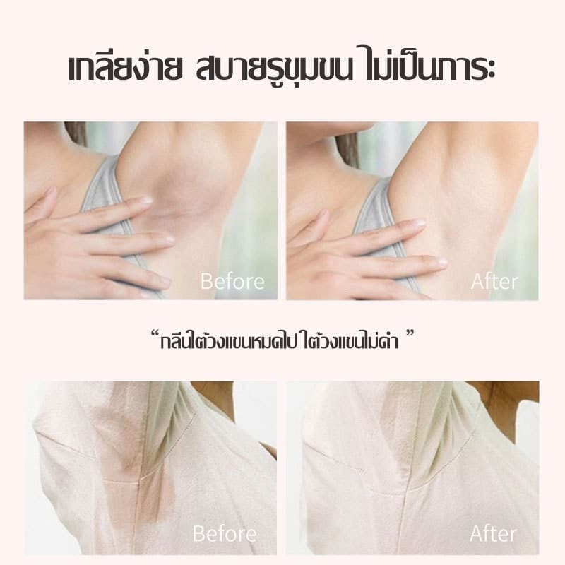 โรลออนมายช้อยส์ ระงับกลิ่นกาย 2กลิ่น 50ml ลดกลิ่นไม่พึงประสงค์ใต้วงแขน สเปรย์ระงับกลิ่นกาย SADOER Roll On Extra รูปที่ 5