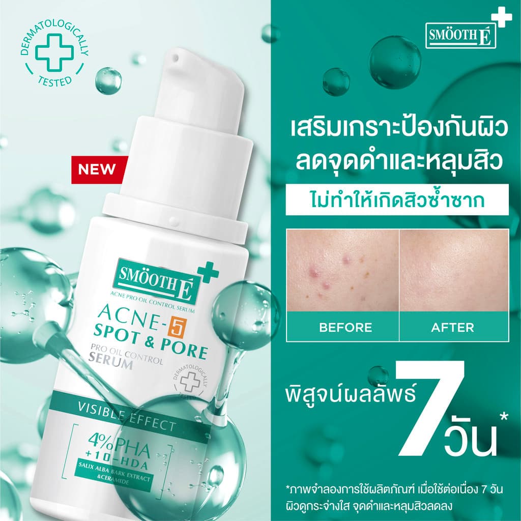 Smooth E 3 Steps Anti Acne Set ดูแลปัญหาสิว ครบจบ ใน 3 ขั้นตอน รูปที่ 9