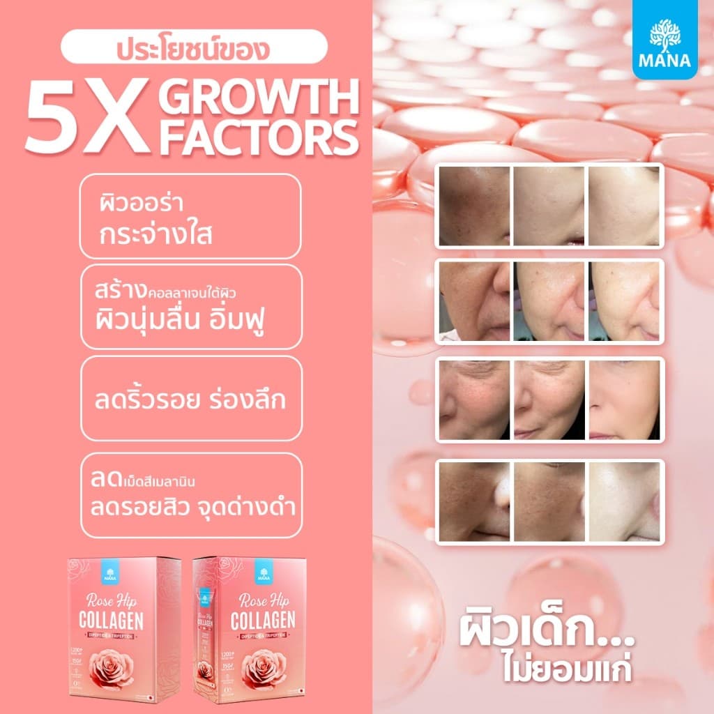 mana collagen ros hip มานาคอลลาเจน คอลลาเจนญาญ่า mana collagen rose hip mana รูปที่ 2