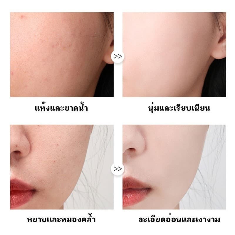 เซตมาส์กหน้า มาส์กหน้ามากมาย ว่านหางจระเข้ คอลลาเจน กรดไฮยาลูโรนิก วิตามินซี ราคาดีกว่า รูปที่ 5