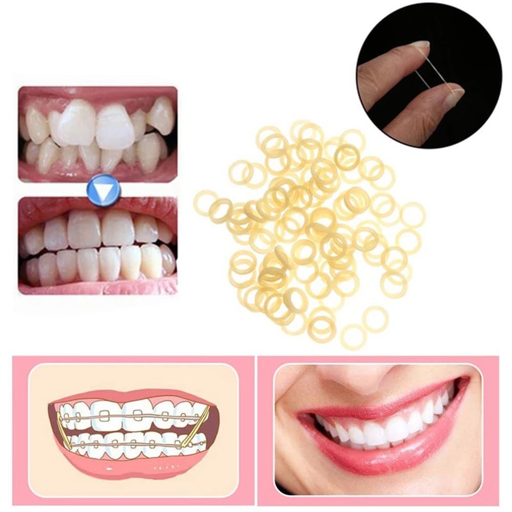 100 ชิ้น/ถุงทันตกรรม Zoo Elastics ยางทันตกรรม Latex 6.5OZ/5.0OZ/3.5OZ รูปที่ 3