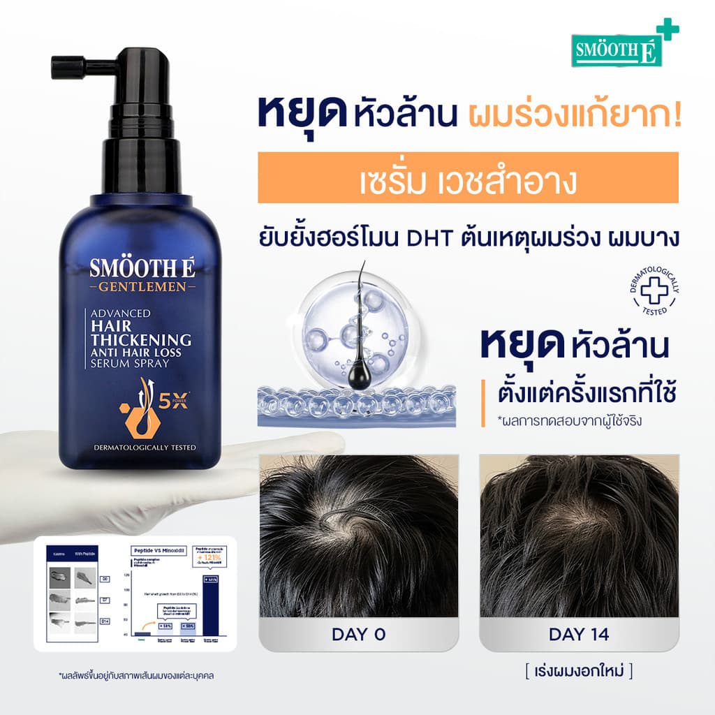Smooth E Hair loss​ หยุดวงจรผมร่วง Smooth E Hair Care Solutions​ ฟื้นบำรุงผมและหนังศีรษะ ลดปัญหาผมร่วง รูปที่ 2