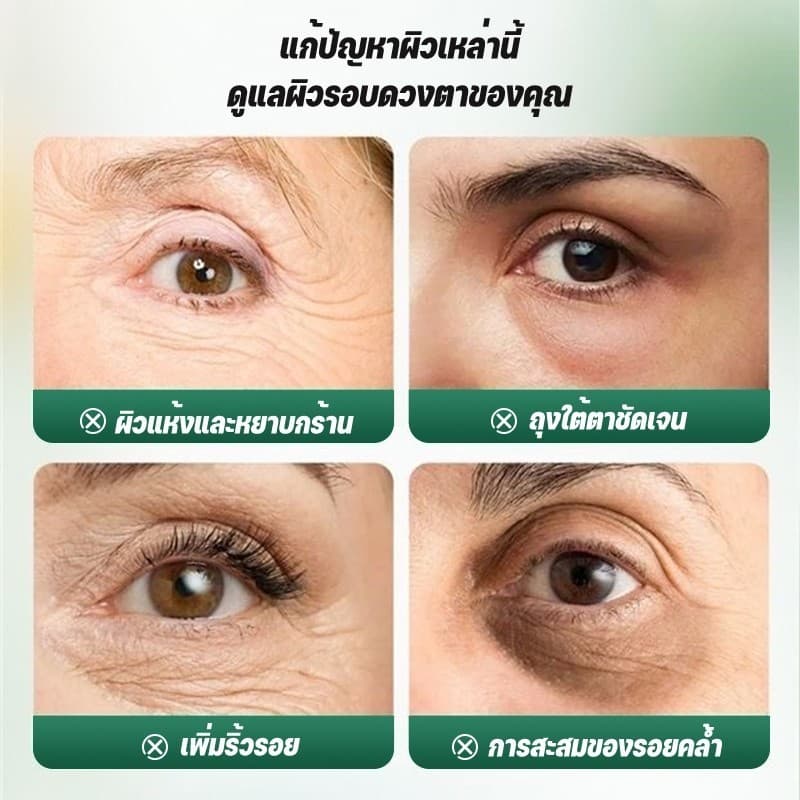 มาส์กตา SADOER มาร์คใต้ตา Eye Mask ยกกระชับชุ่มชื้น ลดรอยคล้ำใต้ตา 3สูตร รูปที่ 4