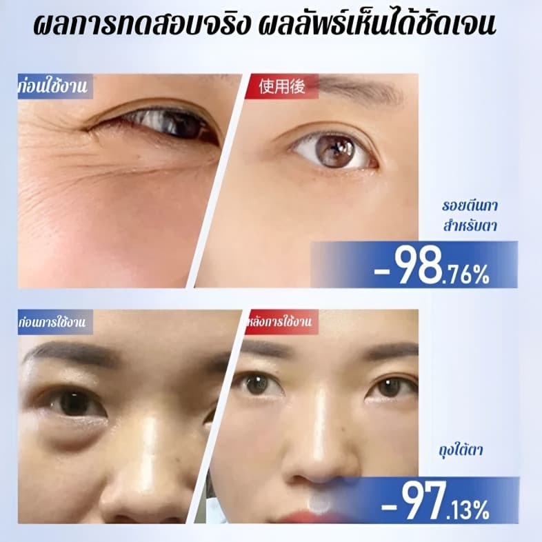 ซื้อ 1 แถม 1มาส์กรอบดวงตา ลดริ้วรอย ยกกระชับ ผิวรอบตาเรียบเนียน ให้ความชุ่มชื้นยาวนาน รูปที่ 3
