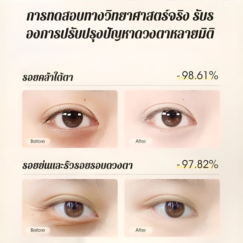 ซื้อ 1 แถม 1มาส์กรอบดวงตา ลดริ้วรอย ยกกระชับ ผิวรอบตาเรียบเนียน ให้ความชุ่มชื้นยาวนาน รูปที่ 6