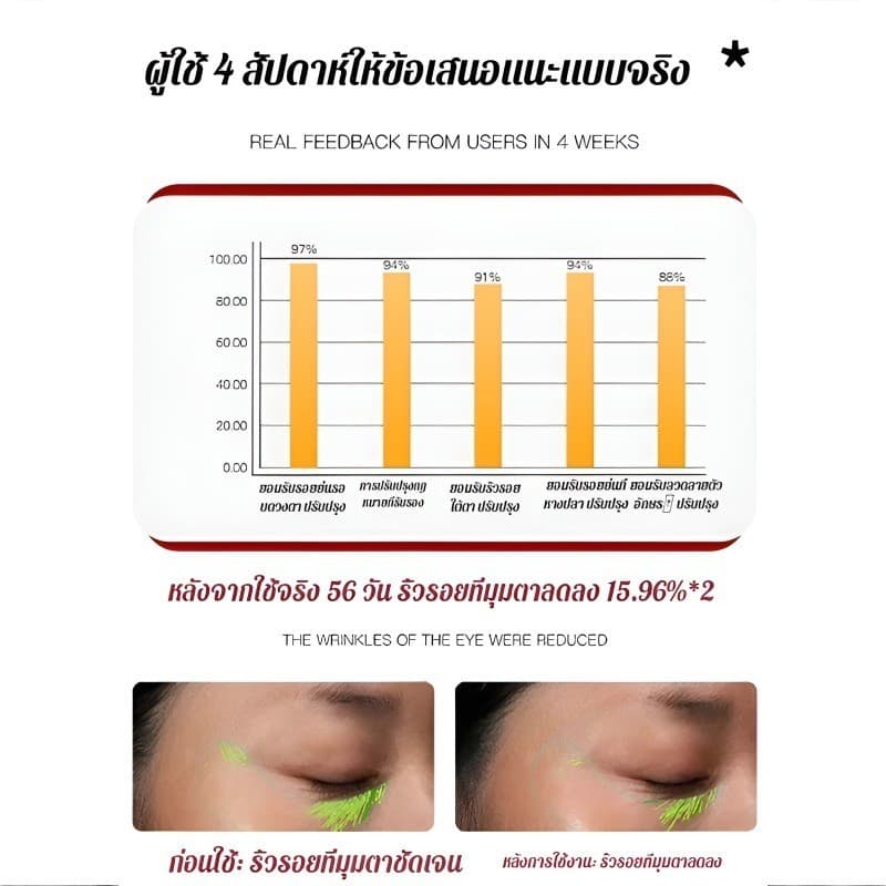 ซื้อ 1 แถม 1มาส์กรอบดวงตา ลดริ้วรอย ยกกระชับ ผิวรอบตาเรียบเนียน ให้ความชุ่มชื้นยาวนาน รูปที่ 7