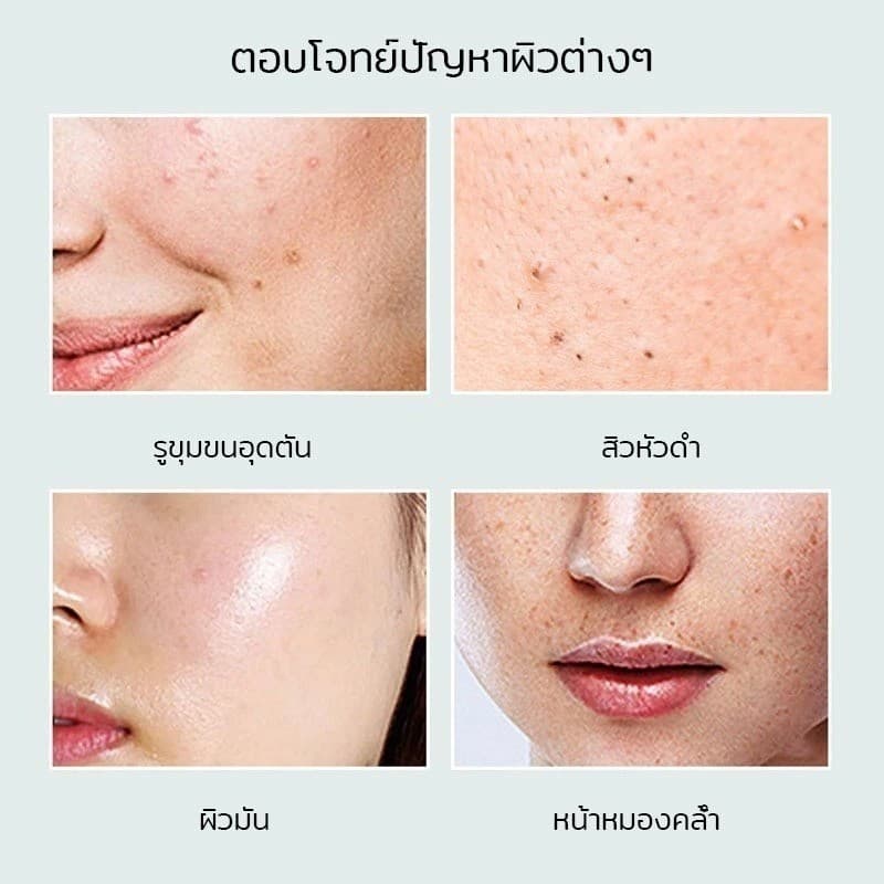 1 แถม 1 มาส์กโคลนมาส์กชาเขียว หน้ากากมะเขือ 40G Green Tea Mask Stick กําจัดสิวหัวดํา ควบคุมความมั รูปที่ 5