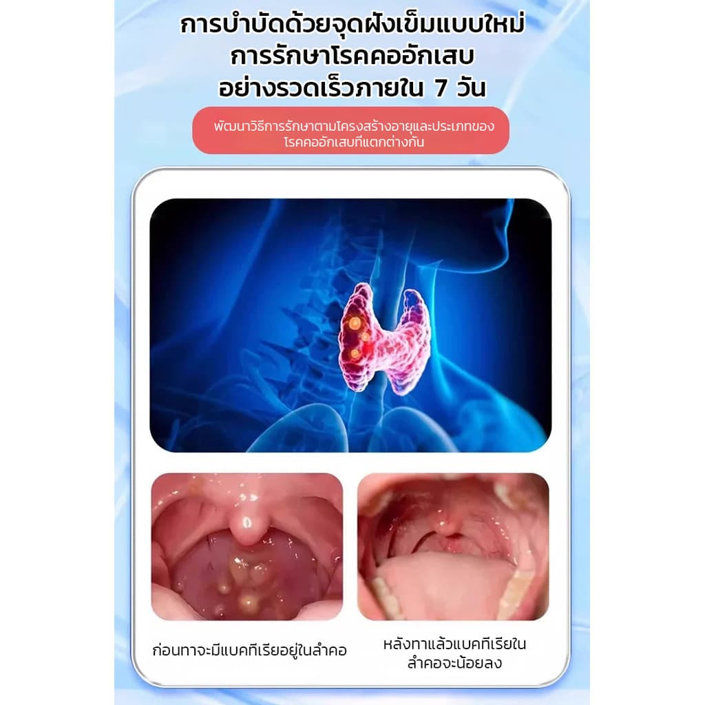 ซื้อ 1 แถม 1 เจลบรรเทาอาการเจ็บคอ เจลบรรเทาอาการเจ็บคอ เจลบรรเทาอาการเจ็บคอ บำรุงสุขภาพ สารสกัดจ รูปที่ 8