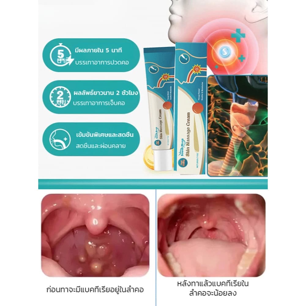 ซื้อ 1 แถม 1 เจลบรรเทาอาการเจ็บคอ เจลบรรเทาอาการเจ็บคอ เจลบรรเทาอาการเจ็บคอ บำรุงสุขภาพ สารสกัดจ รูปที่ 2