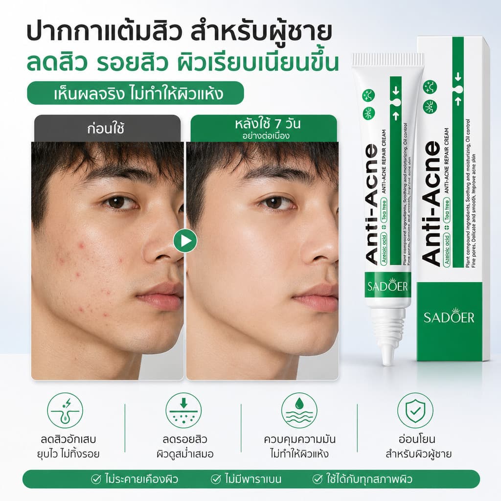 ซื้อ 1 แถม 1 SADOER ครีมลดปัญหาสิว เนื้อครีม ขนาด20กรัม บำรุงผิวหนัง ผลิตภัณฑ์บำรุงผิวหน้า สูตรสำหรับผิวเป็นสิวง่าย รูปที่ 6