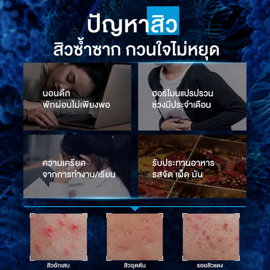La Roche-Posay Effaclar DUO+M ครีมลดสิว คุมมัน ฟื้นฟูผิว 40ml สำหรับผิวเป็นสิว ลดสิวอุดตัน รอยแดง รูขุมขน รูปที่ 7