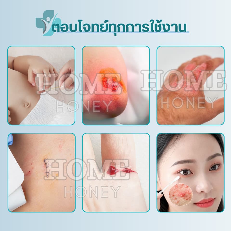 ก้านสำลีบรรจุเบ ตา ดีน ไอโอดีน50ชิ้น ทำแผลฉุกเฉิน พกพาสะดวก คัตตอนบัต ก้านฝ้าย ไม้พันสำลีปลอดเชื้อ สำลีก้าน รูปที่ 8