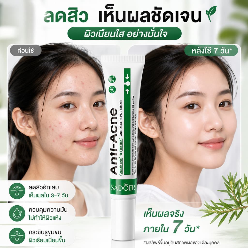 ซื้อ 1 แถม 1 SADOER ครีมลดปัญหาสิว เนื้อครีม ขนาด20กรัม บำรุงผิวหนัง ผลิตภัณฑ์บำรุงผิวหน้า สูตรสำหรับผิวเป็นสิวง่าย รูปที่ 7