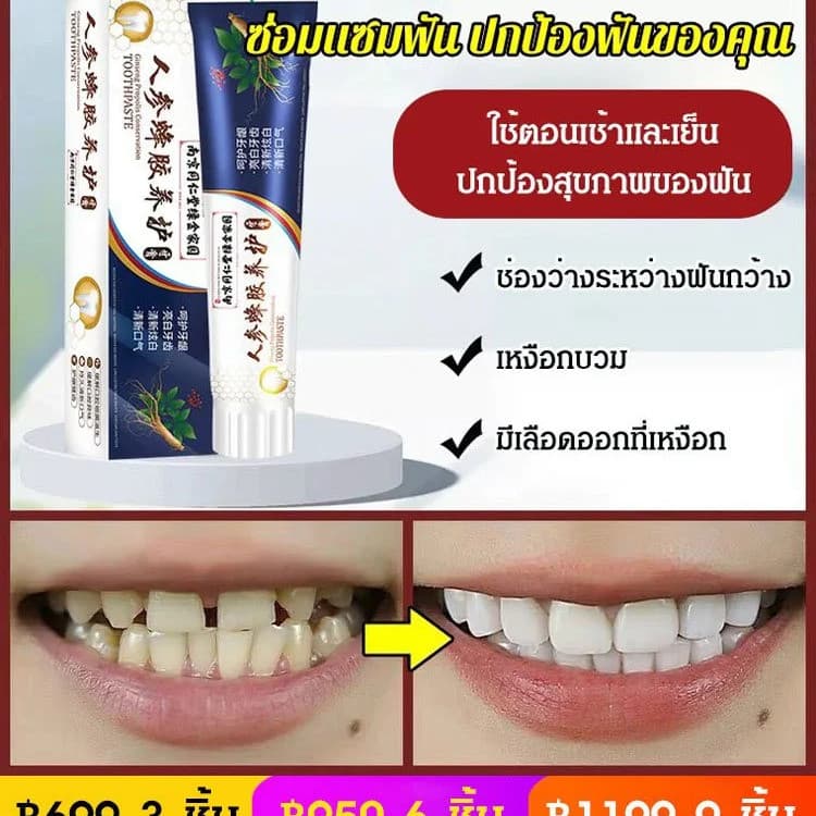 ยาสีฟันสูตรญี่ปุ่น สำหรับฟันโยก แก้ปัญหาเหงือกร่น/ยาสีฟันแก้ฟันโยก/ฟันแข็งแรง/ดูแลช่องปาก รูปที่ 2