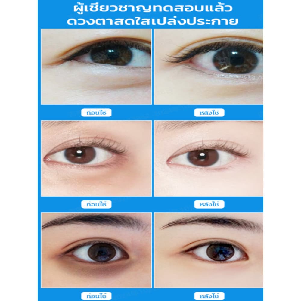 แผ่นมาสก์ตาไฮยาลูโรนิก Hyaluronic Acid Eye Mask/Puffiness Reduction/Dark Circles Treatment/Anti-Aging/Skin Hydration รูปที่ 5