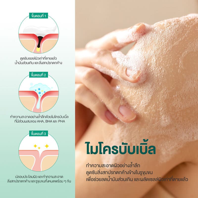 SOME BY MI AHA-BHA-PHA 30 Days Miracle Acne Clear Body Cleanser 400g คลีนเซอร์สำหรับผิวกายที่เป็นสิว ซัมบายมี. รูปที่ 4