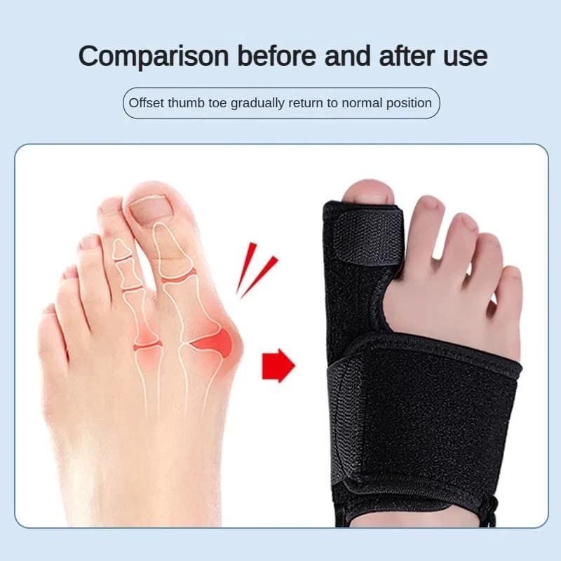 Toe Corrector Orthotics Bone Thumb Adjuster ค้อน Protector Soft Pedicure ถุงเท้า Bunion Straightener เครื่องมือดูแลเท้า รูปที่ 4