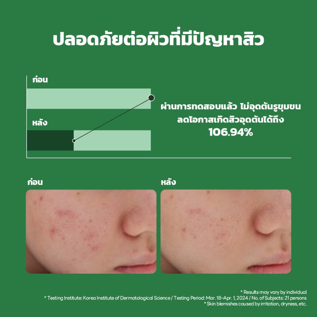 MEDIHEAL OFFICIAL Tea tree Calming Moisture Serum 40ml : Gentle Calming Effect ไม่ระคายเคืองสําหรับผิวแพ้สิว รูปที่ 6
