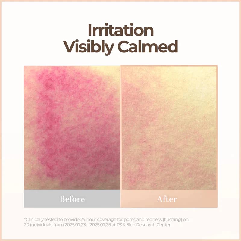 Skin Blemish Balm Intensive BB Cream 30ml 6Colors - Tinted Moisturizer BB Cream รูปที่ 8