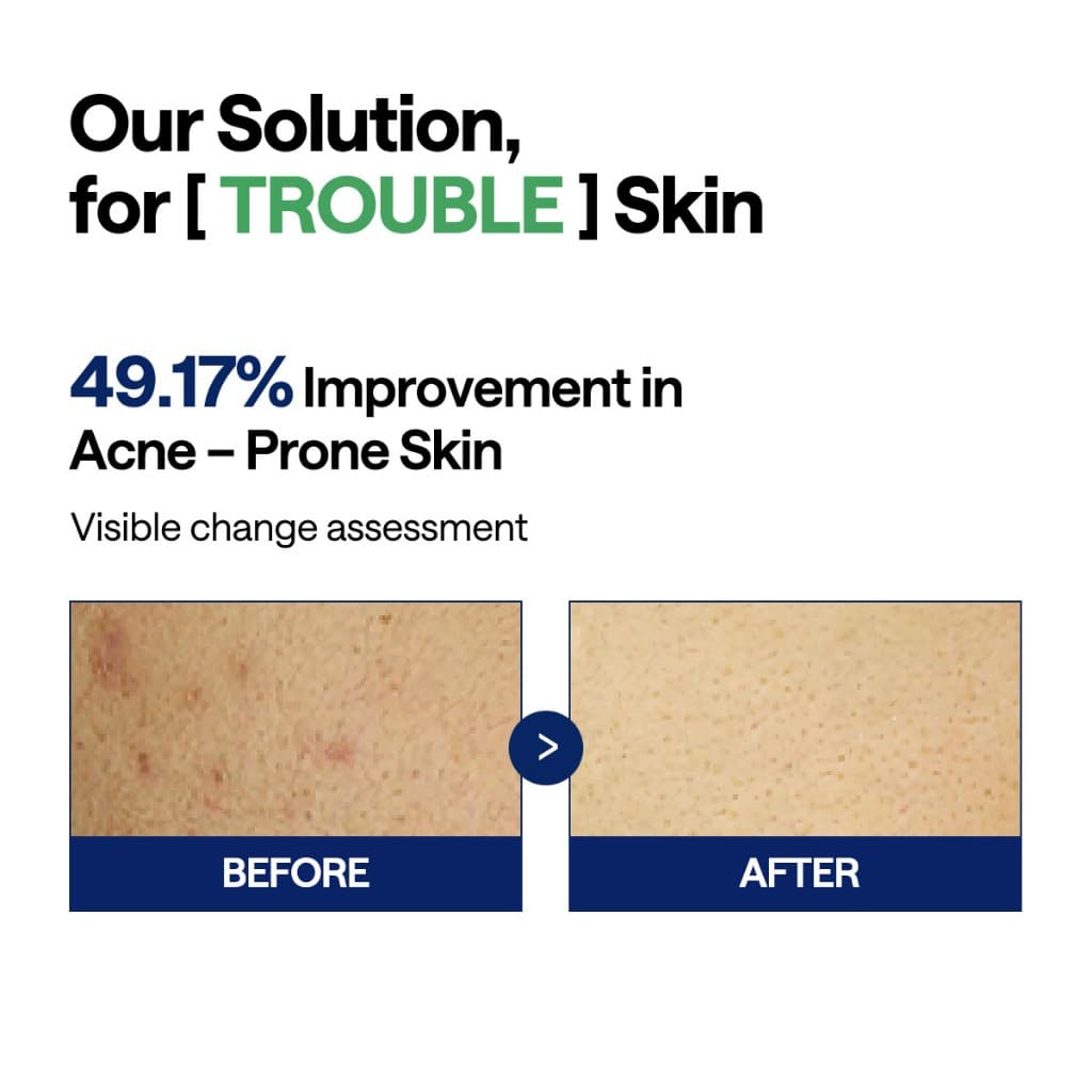 MEDIHEAL Teatree Trouble Toner Pad - แพดลดสิว ขนาดพกพา รูปที่ 2