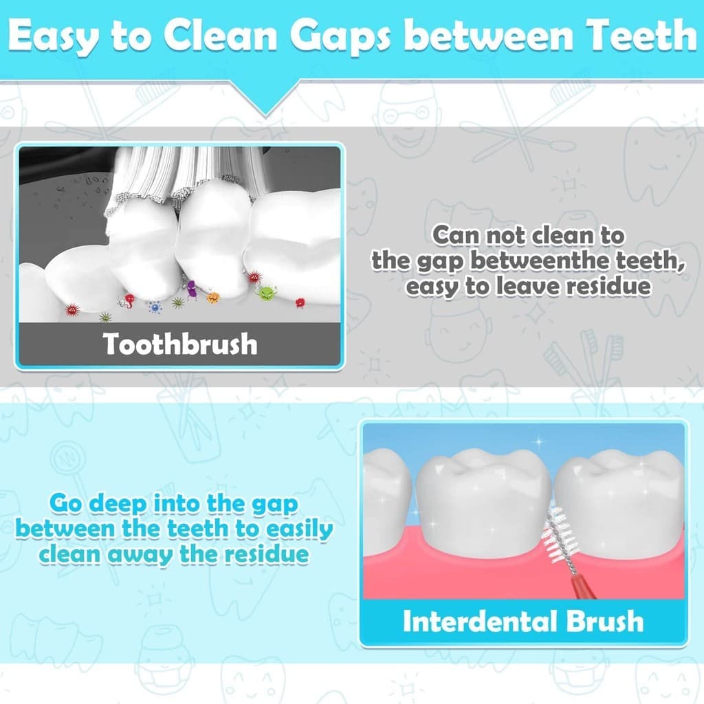 Braces Brush Cleaner 60 ชิ้น: แปรงสีฟัน Interdental สําหรับการดูแลทันตกรรมจัดฟันและเครื่องมือกําจัดสิวหัวดํา รูปที่ 3