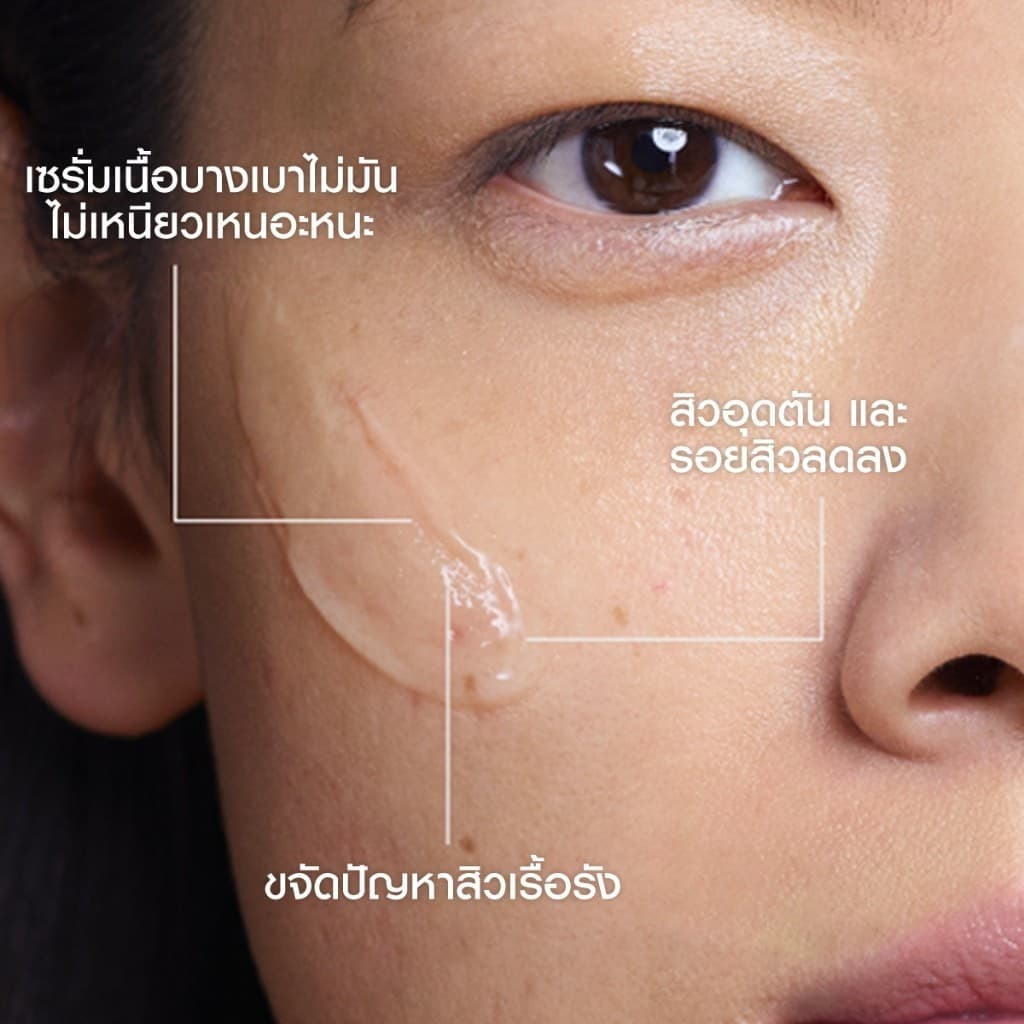 ลา โรช-โพเซย์ La Roche-Posay EFFACLAR SERUM 30ml. เซรั่มสลายสิวอุดตันที่ต้นตอ 30ml. + Foaming Gel 7ml รูปที่ 4