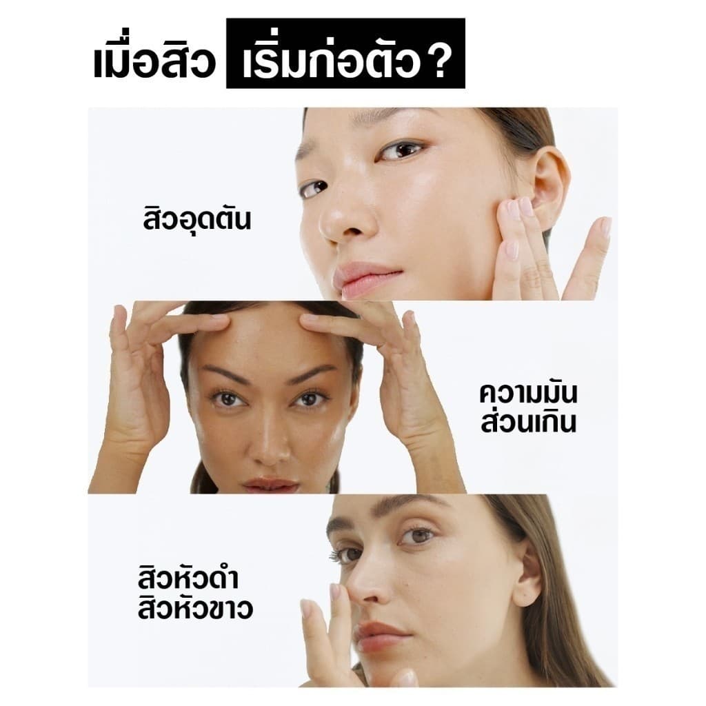 Neutrogena DC Acne FC 150 g x 2 นูโทรจีนา ดีพ คลีน แอคเน่ โฟมมิ่ง คลีนเซอร์ 150 กรัม x 2, โฟมล้างหน้า, ลดการเกิดสิวใหม่ รูปที่ 4