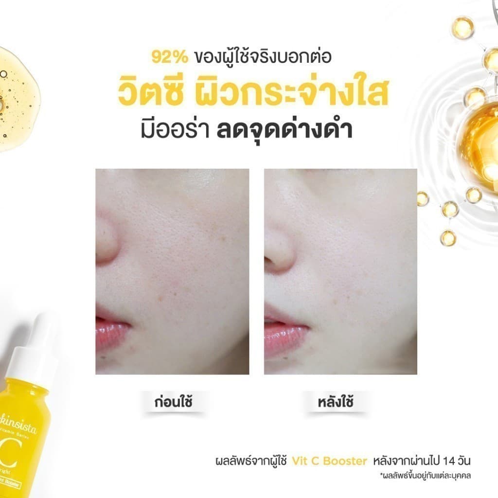 Skinsista Vit C บูสเตอร์เซรั่ม วิตซี ลดรอยสิว เพื่อผิวสว่าง กระจ่างใส 15ml รูปที่ 6