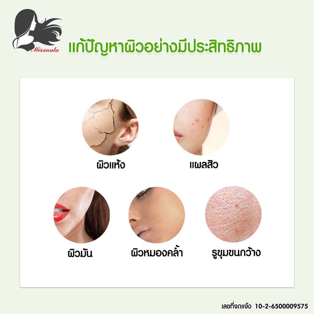Missnala ALOE VERA TONER โทนเนอร์ สารสกัดจากว่านหางจระเข้ ขนาด 150 ml. รูปที่ 4
