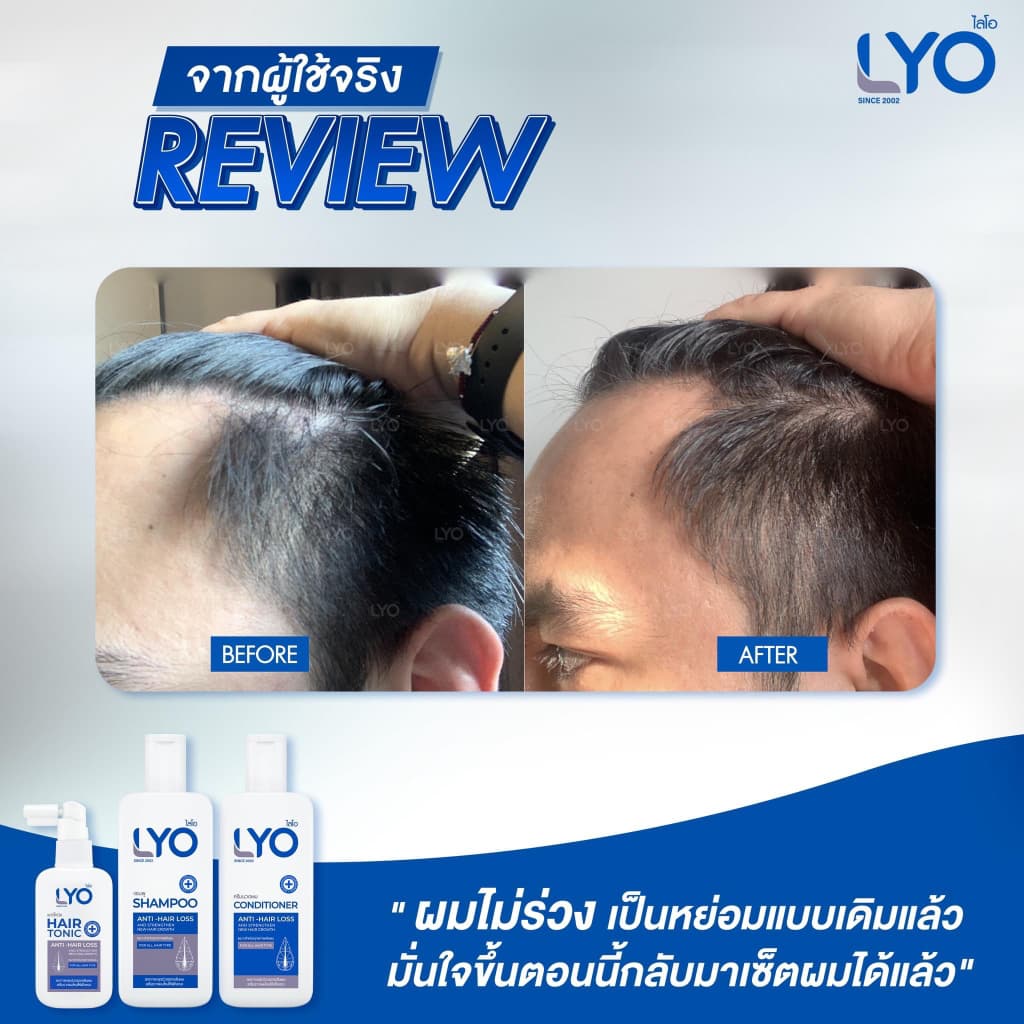LYO Hair Tonic 30 ml. ไลโอ แฮร์โทนิค เซรั่มผม หนุ่มกรรชัย แชมพูสระผม ยาสระผม แชมพู ของแท้ Official รูปที่ 7