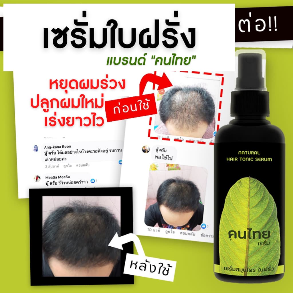 ลดหัวล้าน เซรั่มใบฝรั่ง ปลูกผมผู้ชาย ลดผมร่วง ผมดก ลองโควิด ยาปลูกหนวดเครา รูปที่ 4