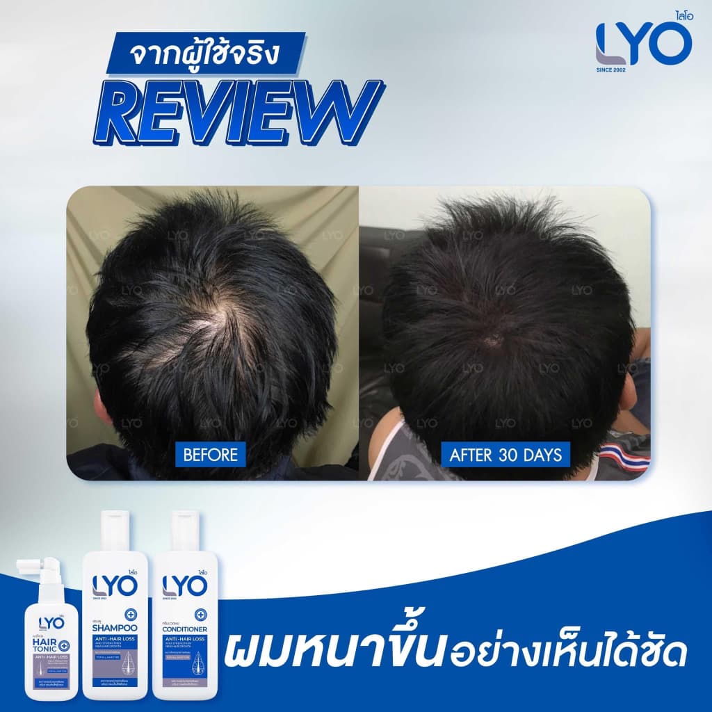 LYO Hair Tonic 30 ml. ไลโอ แฮร์โทนิค เซรั่มผม หนุ่มกรรชัย แชมพูสระผม ยาสระผม แชมพู ของแท้ Official รูปที่ 8
