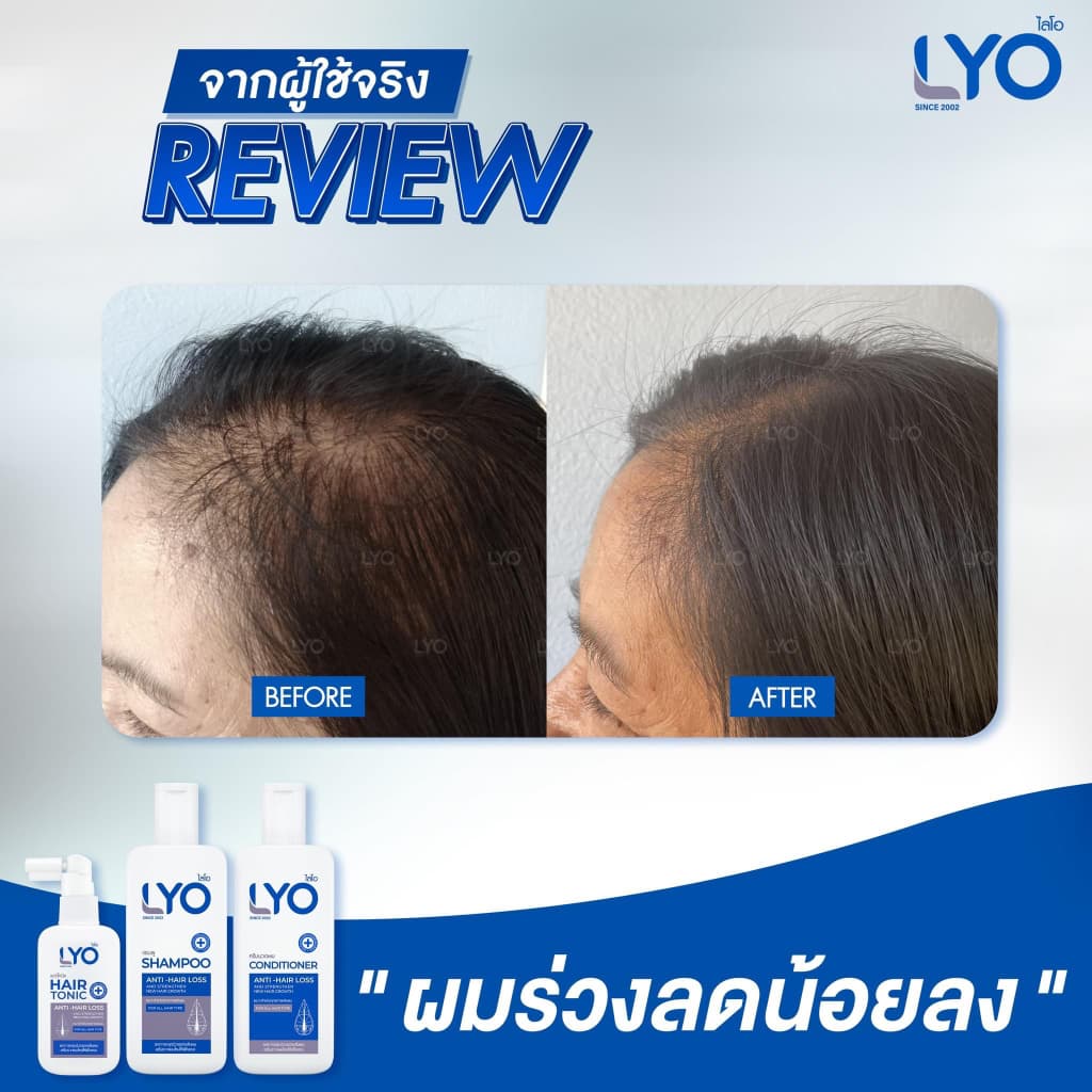 LYO Hair Tonic 30 ml. ไลโอ แฮร์โทนิค เซรั่มผม หนุ่มกรรชัย แชมพูสระผม ยาสระผม แชมพู ของแท้ Official รูปที่ 5