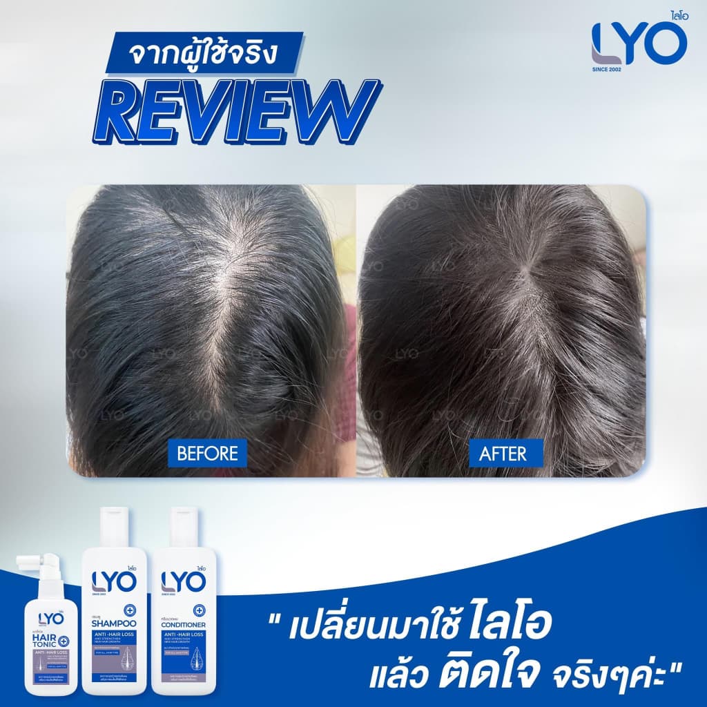 LYO Hair Tonic 30 ml. ไลโอ แฮร์โทนิค เซรั่มผม หนุ่มกรรชัย แชมพูสระผม ยาสระผม แชมพู ของแท้ Official รูปที่ 6
