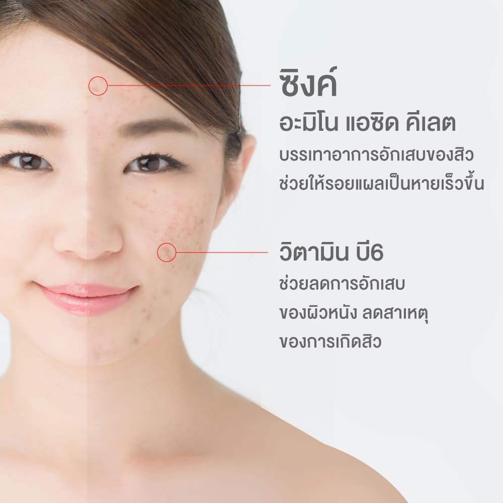 InterCare Zinc plus ซิงค์ 75 mg สารสกัดจาก USA และวิตามินรวม 8 ชนิด บรรเทาปัญหาสิว รูปที่ 5