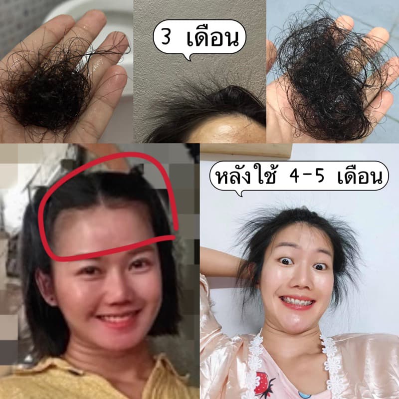 แชมพูสมุนไพรสด อัญชันสด สมุนไพรรวม 13ชนิด ขนาด 1,000 ml. แถมฟรีขวดบีบ รูปที่ 3