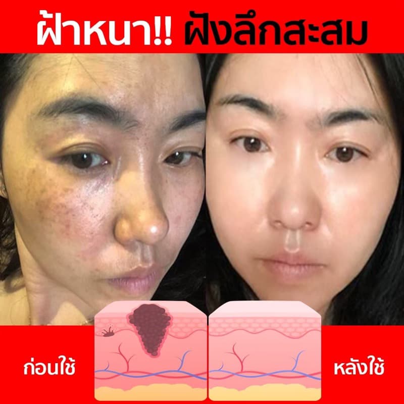 พิเศษ 𝗠𝗶𝗻𝗻𝗶𝘀𝗲 𝗔𝗿𝗯𝘂𝘁𝗶𝗻𝗖+ เซรั่มลดฝ้ากระหน้าเงา โดสเข้มข้น รูปที่ 6