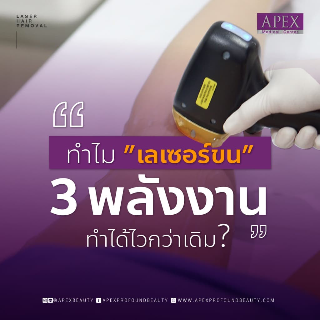 APEX เลเซอร์กำจัดขน กำจัดขนรักแร้ โปรพิเศษ 10 ครั้ง/1 ปี X3 พลังเลเซอร์ เครื่องกำจัดขน เห็นผลไว ยิงลึก รูปที่ 5