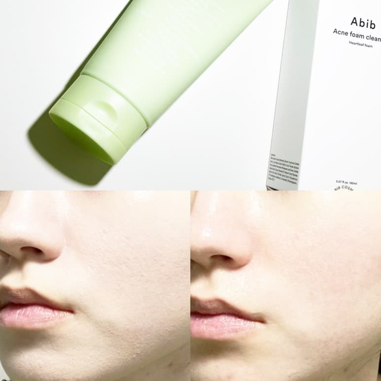 Abib Acne Foam Cleanser Heartleaf Foam / Sedum Hyaluron Foam 150mL โฟมล้างหน้าสูตรอ่อนโยน รูปที่ 2