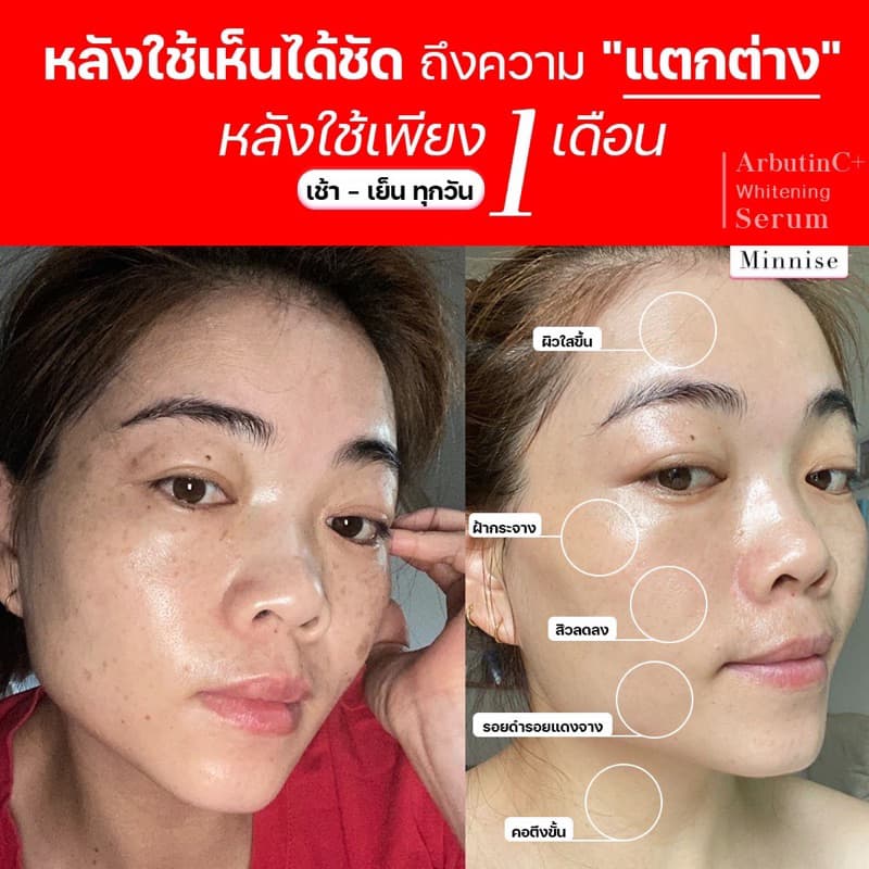 พิเศษ 𝗠𝗶𝗻𝗻𝗶𝘀𝗲 𝗔𝗿𝗯𝘂𝘁𝗶𝗻𝗖+ เซรั่มลดฝ้ากระหน้าเงา โดสเข้มข้น รูปที่ 7