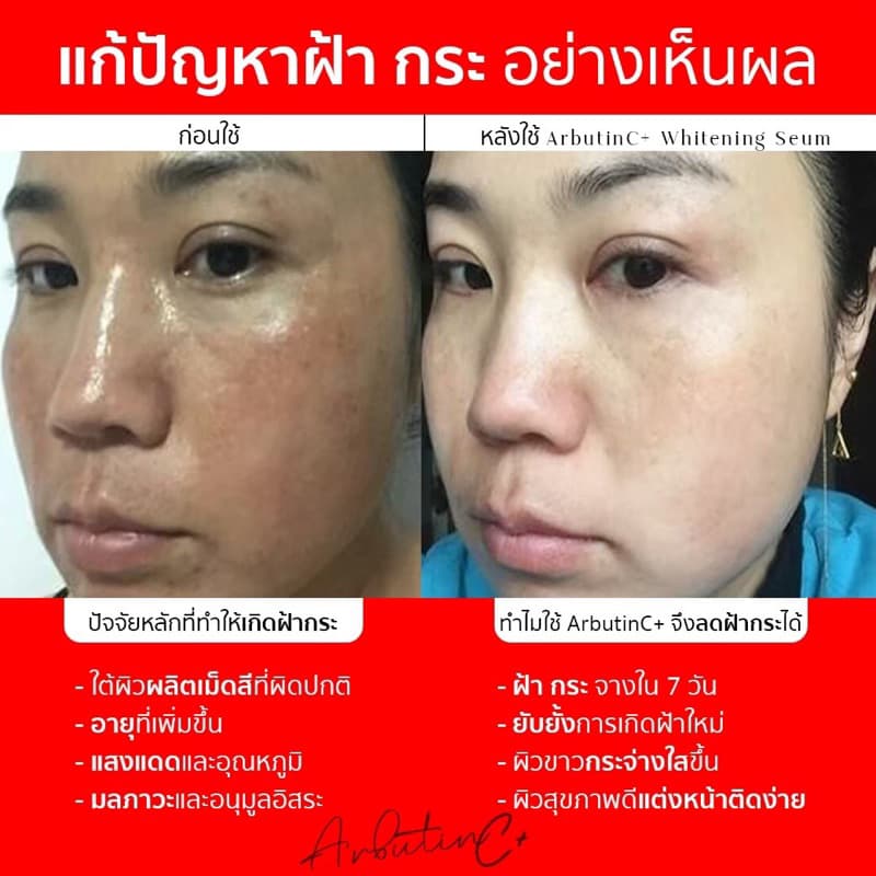 พิเศษ 𝗠𝗶𝗻𝗻𝗶𝘀𝗲 𝗔𝗿𝗯𝘂𝘁𝗶𝗻𝗖+ เซรั่มลดฝ้ากระหน้าเงา โดสเข้มข้น รูปที่ 5