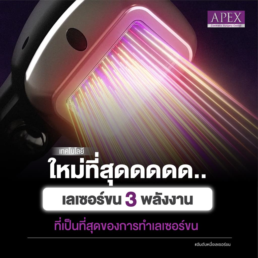 APEX เลเซอร์กำจัดขน กำจัดขนรักแร้ โปรพิเศษ 10 ครั้ง/1 ปี X3 พลังเลเซอร์ เครื่องกำจัดขน เห็นผลไว ยิงลึก รูปที่ 8