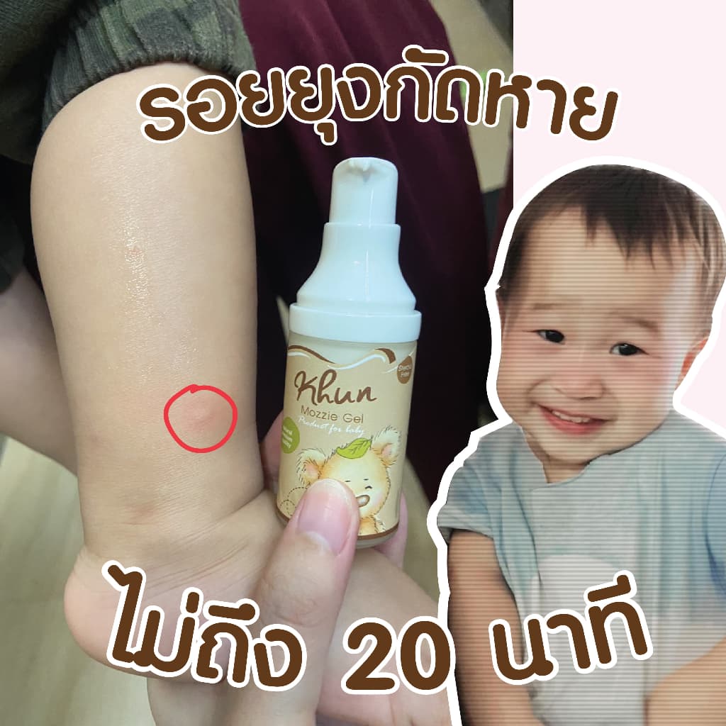 2ชิ้นถูกกว่า! KHUN คุนเจลทารอยยุงกัด ไม่ทิ้งรอยดำ สูตรออร์แกนิค อ่อนโยน สำหรับเด็ก 18ml. รูปที่ 3